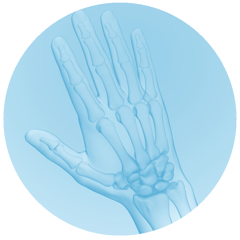 Osteoartrit1.png